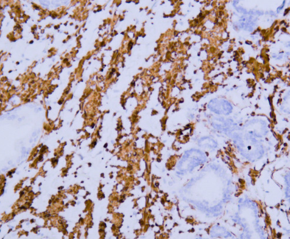 Myosin Heavy Chain, Smooth Muscle Mouse mAb