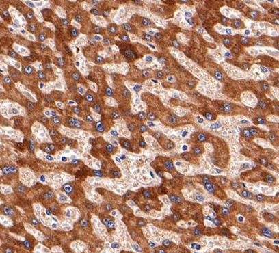 ADFP / PLIN2 Rabbit mAb
