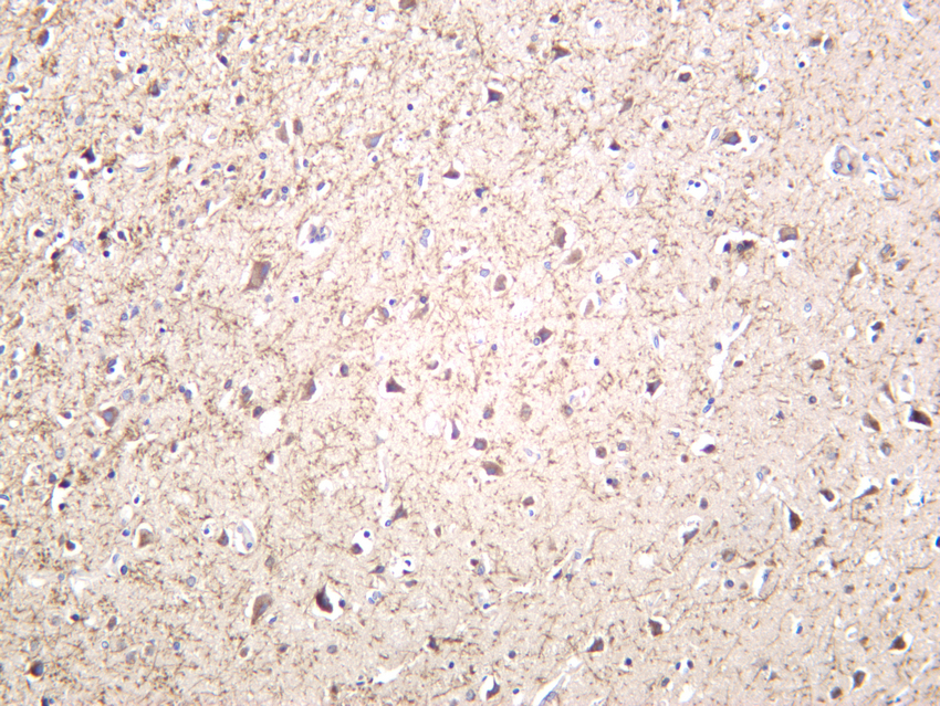 Amyloid-&beta; (1-42) Rabbit mAb