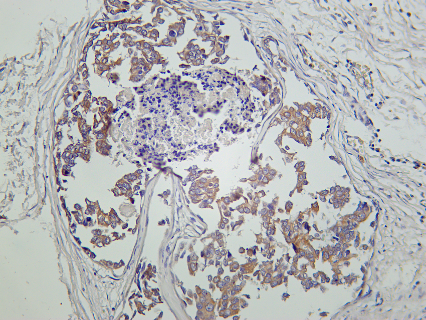 ALIX Rabbit mAb