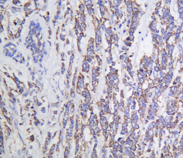 G3BP1  Rabbit mAb