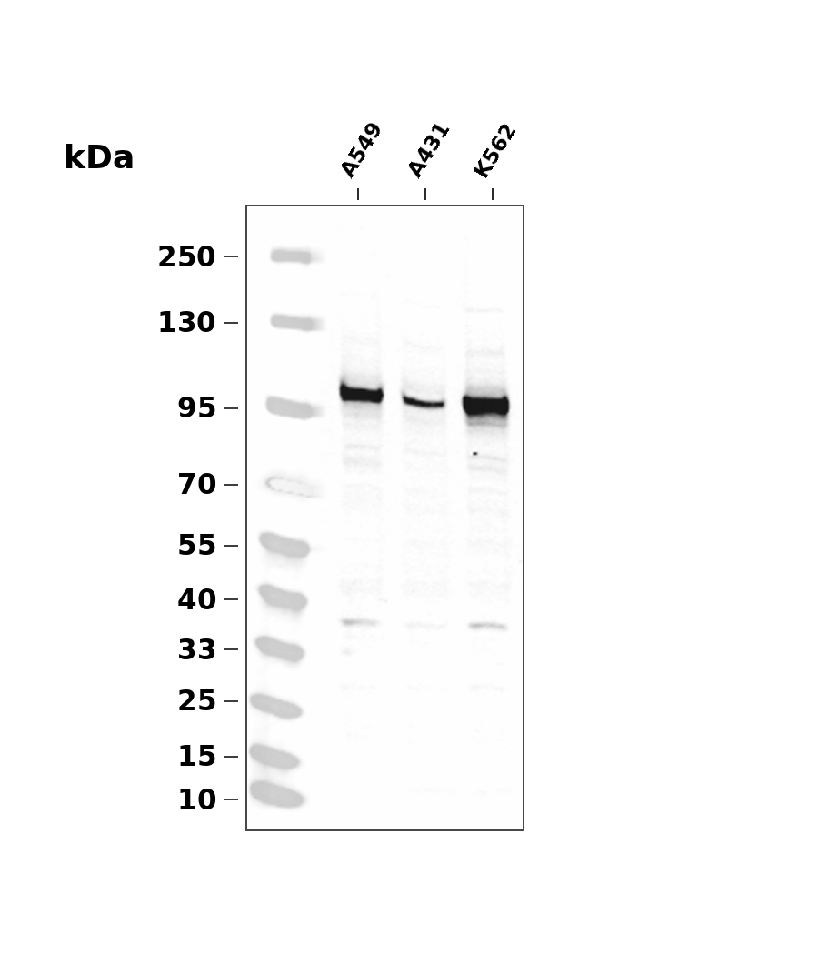 HMGCR Rabbit mAb
