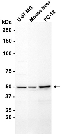 LXR alpha Rabbit mAb