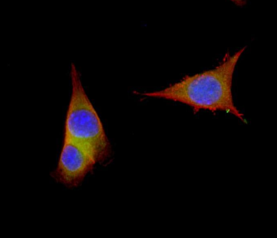 Tryptophan Hydroxylase (YD14751) Rabbit mAb