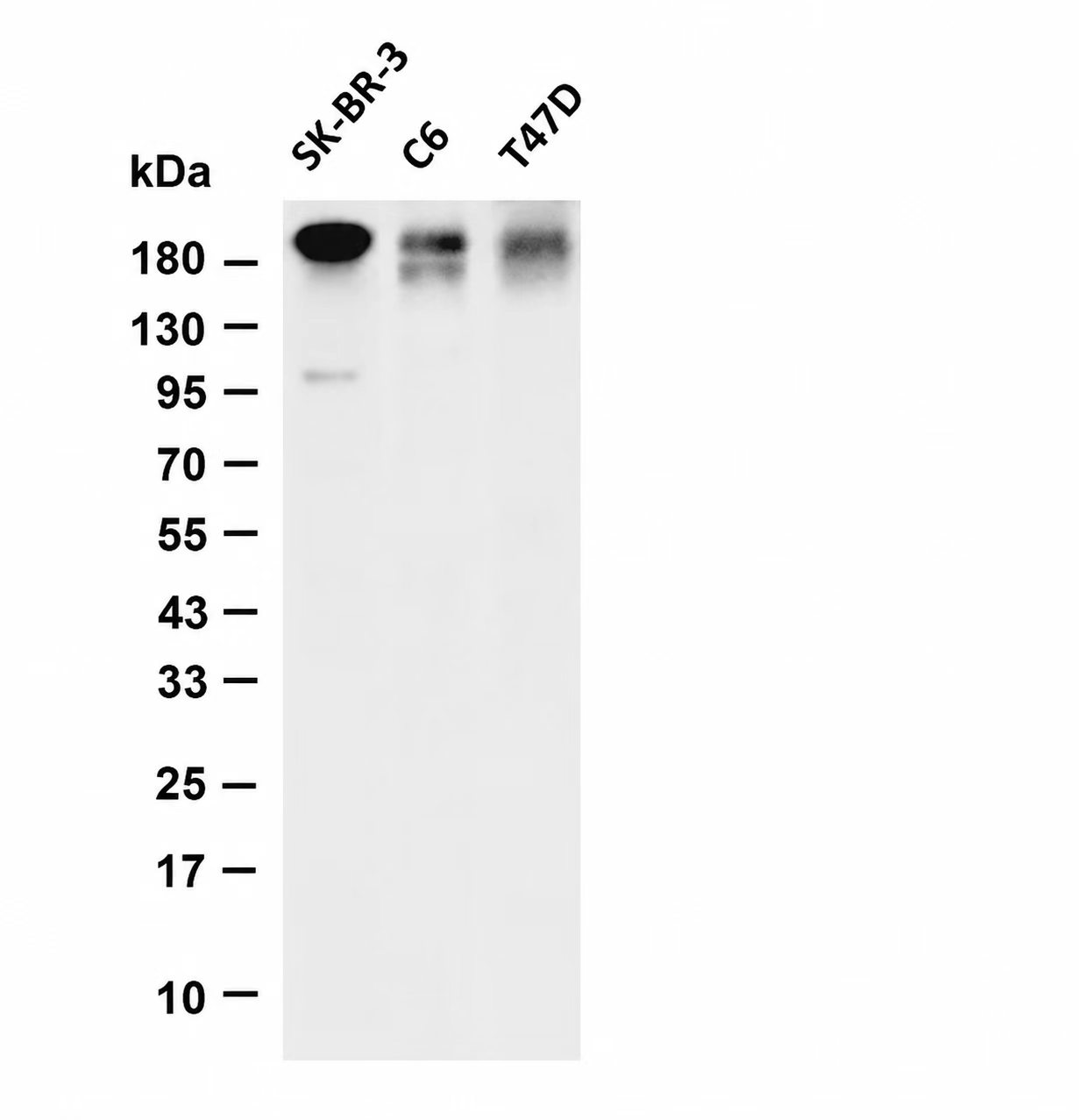 HER2 Rabbit mAb