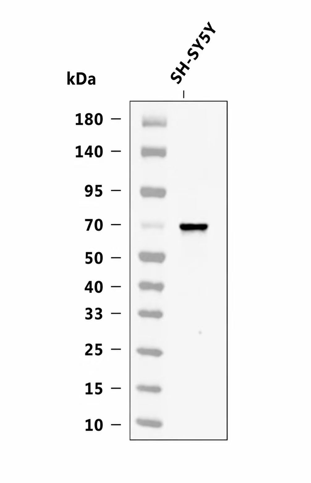 COL25A1 Antibody