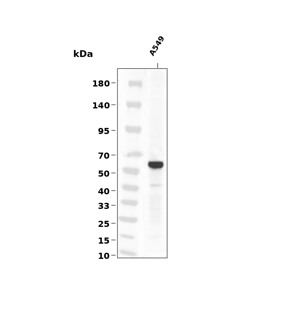 SMAD2 (Phospho Ser465/467)  Rabbit mAb