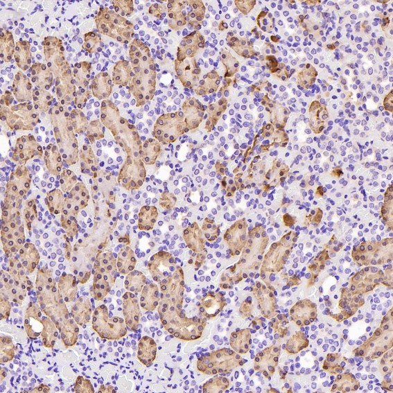 Glutamine Synthetase Rabbit mAb