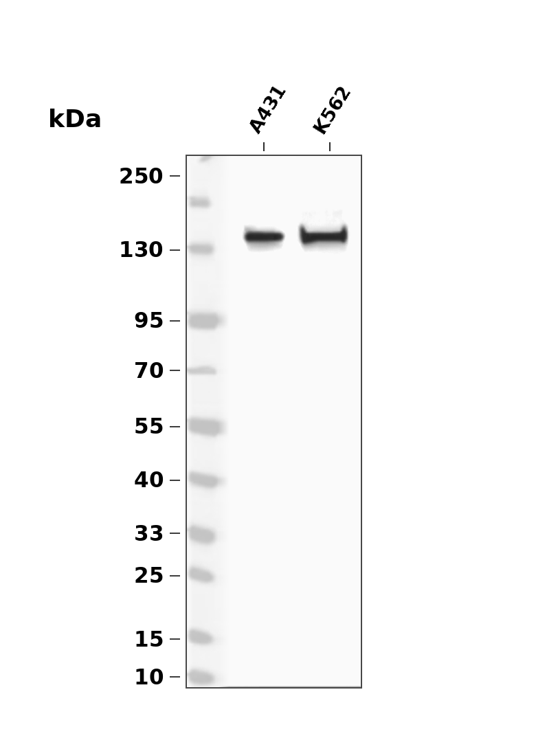 PERK (Phospho Thr980)  Rabbit mAb