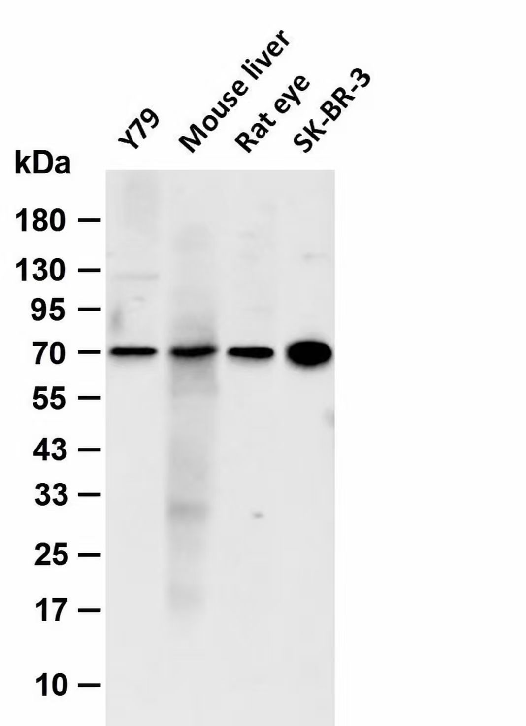 EAAT2/SLC1A2 Rabbit mAb