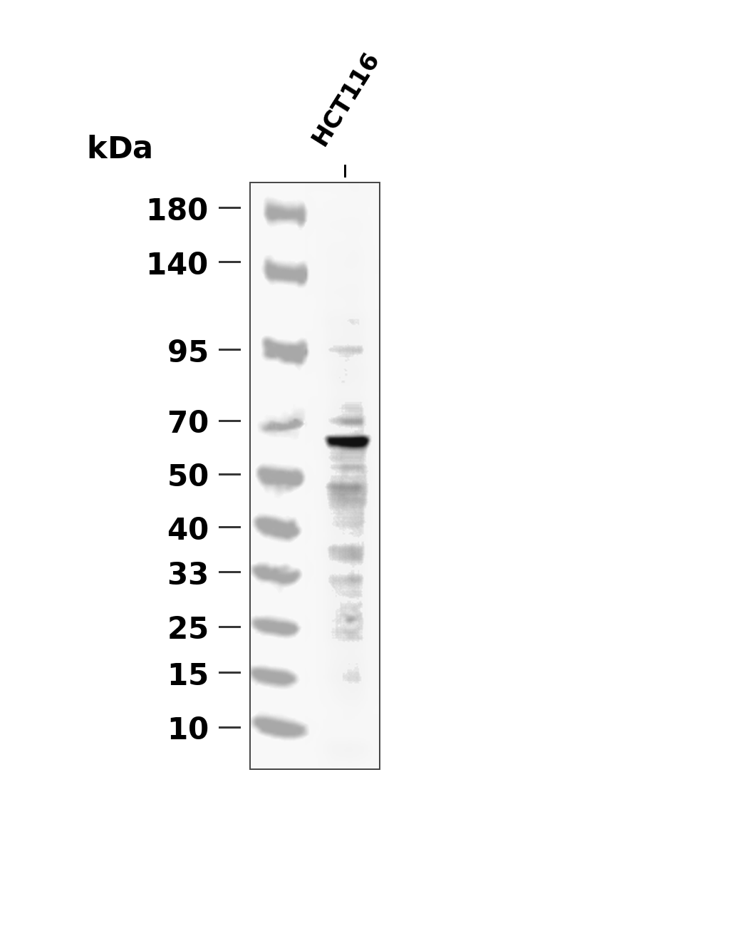 LIMK1 (Phospho-Thr508) Antibody