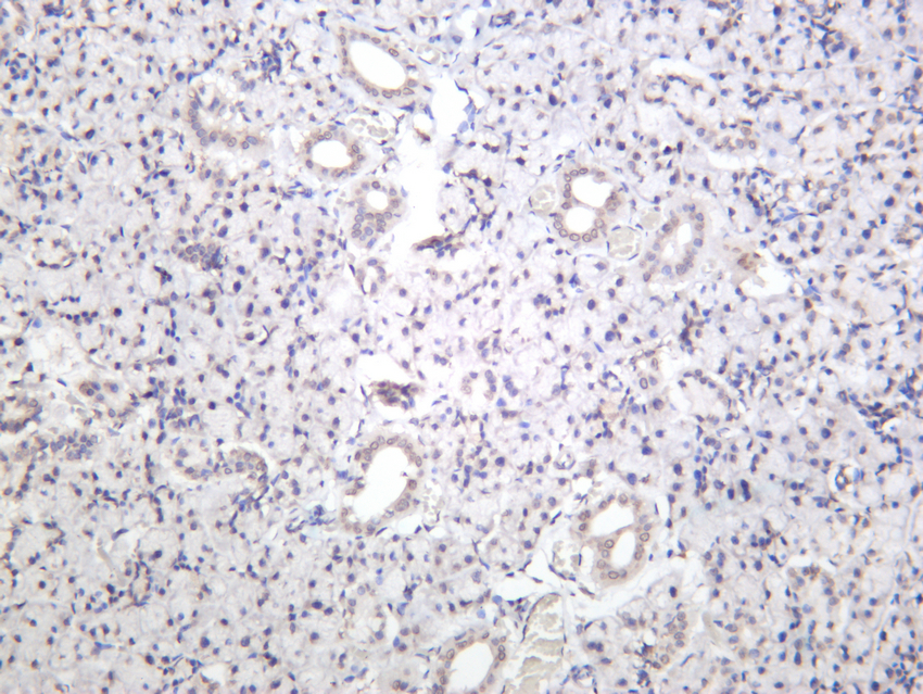 YAP Rabbit mAb