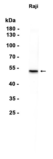 p53 (Phospho Ser392) Rabbit mAb