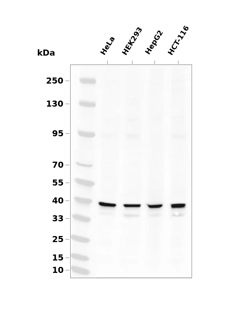 PRKACA Rabbit mAb