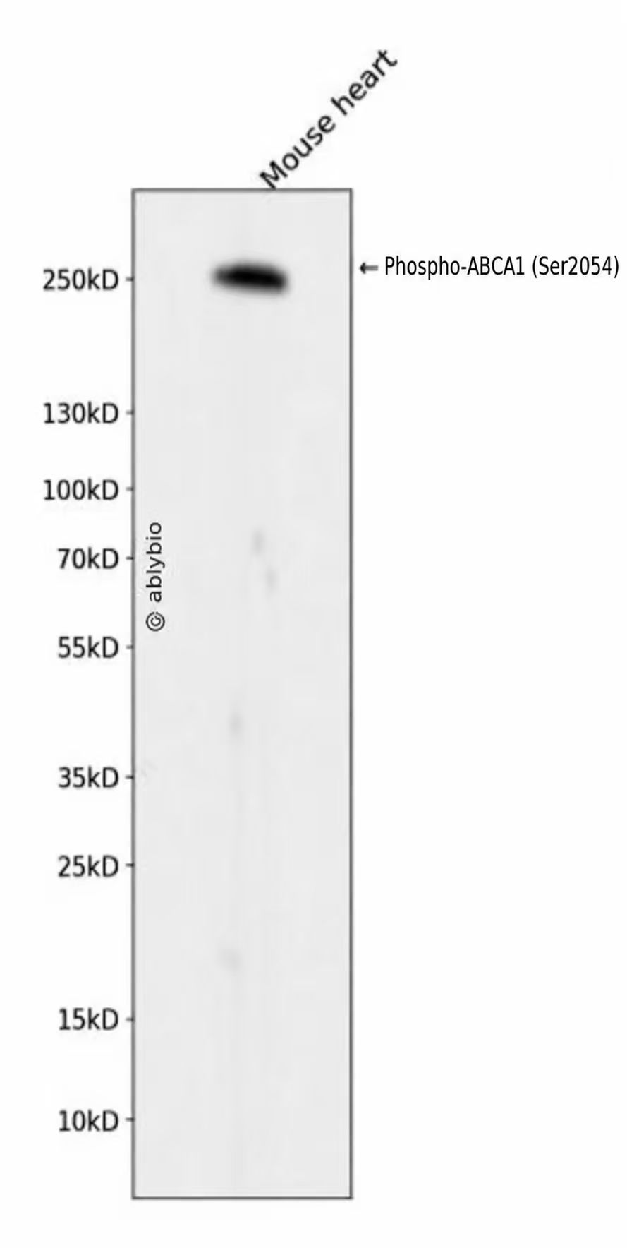 Phospho-ABCA1 (Ser2054) (YD33638) Rabbit mAb