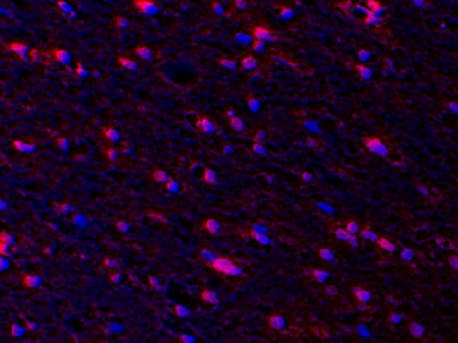 NeuN Rabbit mAb