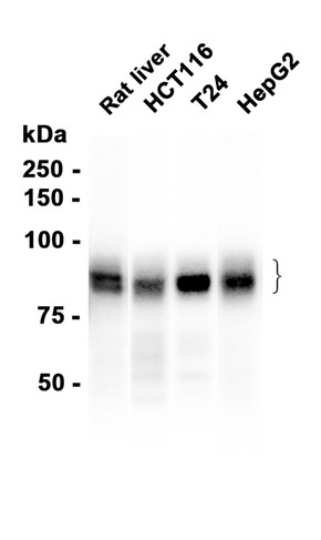 Cortactin (YD14205) Rabbit mAb