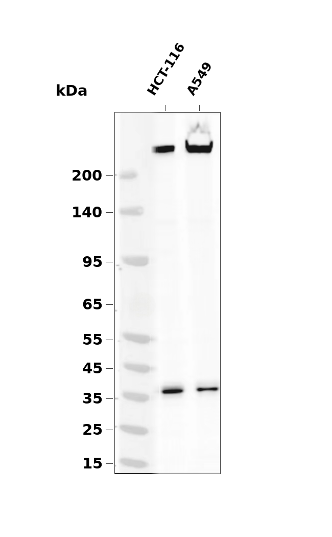 non-muscle Myosin IIA (YD11145)（MYH9） Rabbit mAb