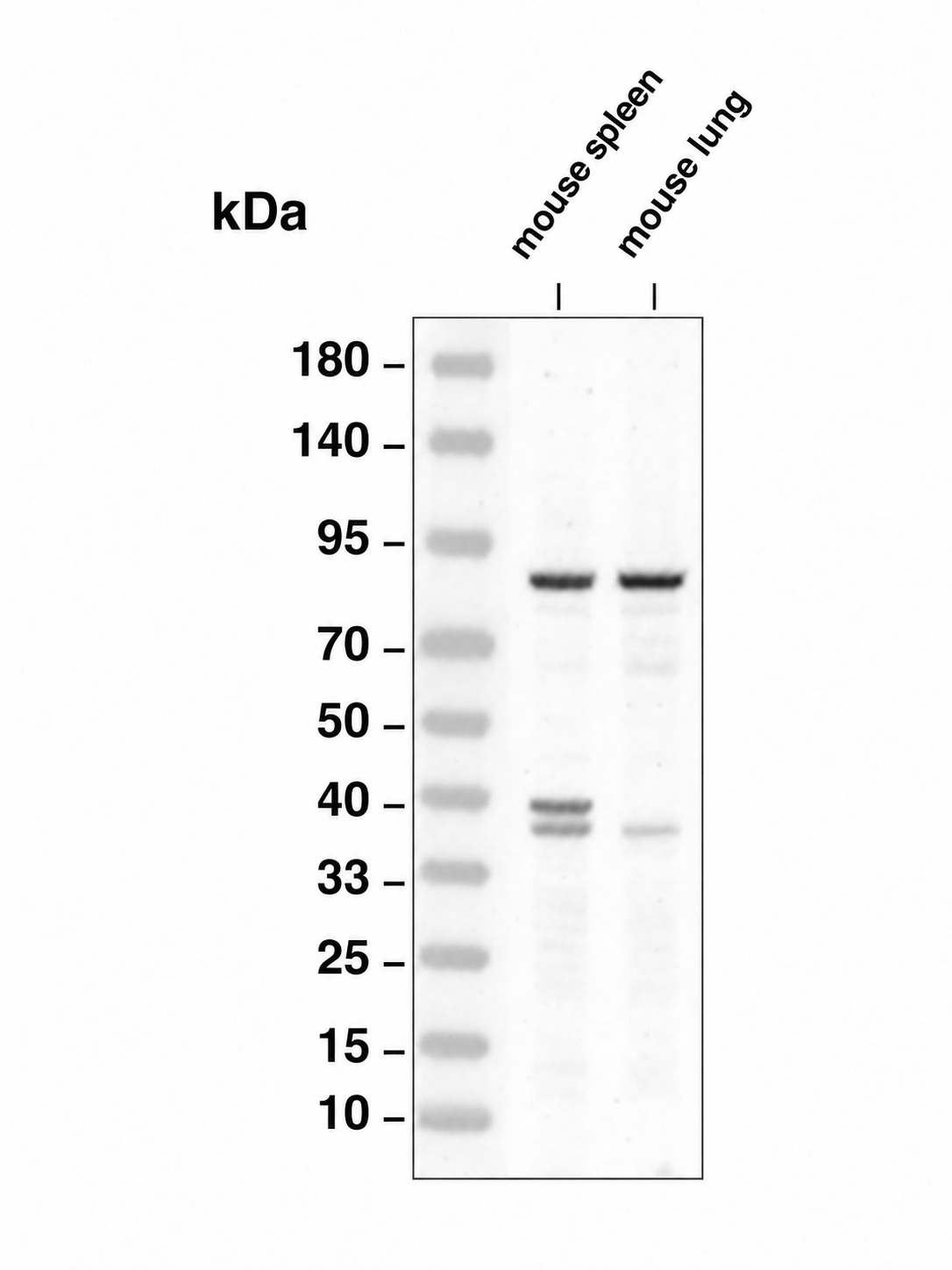 MMP9 Rabbit mAb