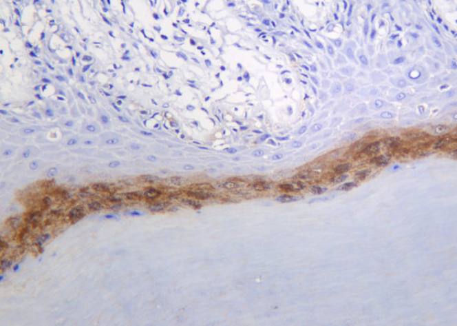 LORICRIN (YD16735) Rabbit mAb