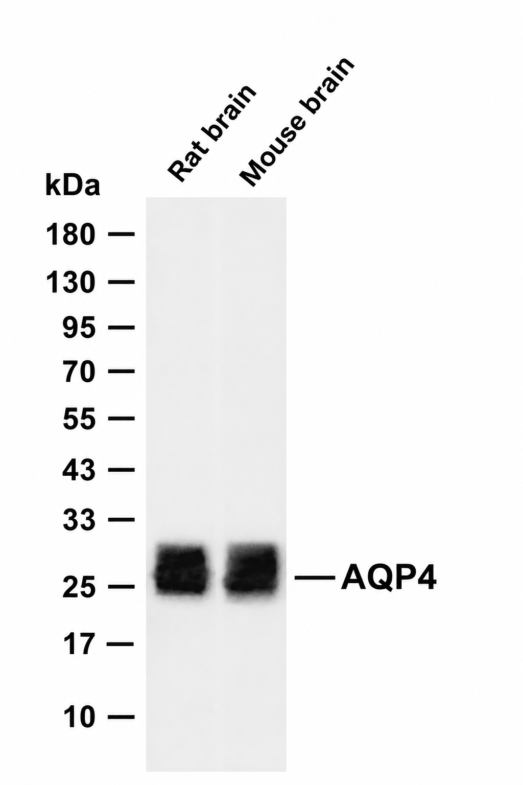 AQP4 Rabbit mAb