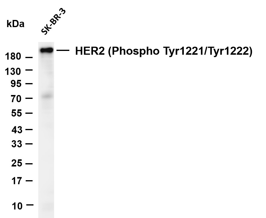 Phospho-ErbB 2 (Tyr1221/Tyr1222) (YD32126) Rabbit mAb