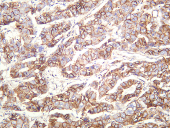 Phospho-delta 1 Catenin (Thr310) (YD12940) Rabbit mAb