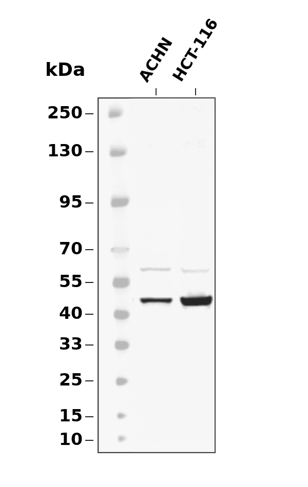 MCT4 Rabbit mAb