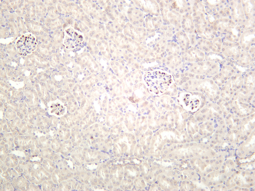 Wilms Tumor Protein Rabbit mAb