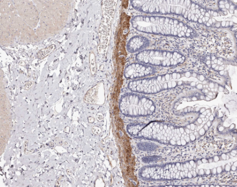 Transglutaminase 2 Rabbit mAb