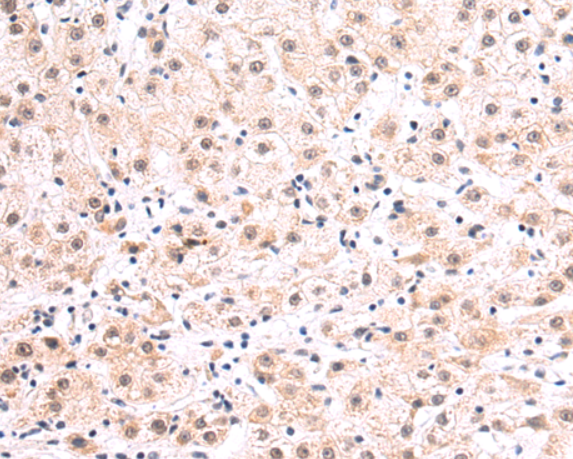 ELOVL1 Antibody