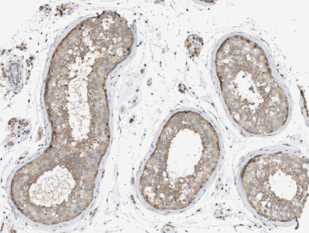 IRS2 (YD13423) Rabbit mAb