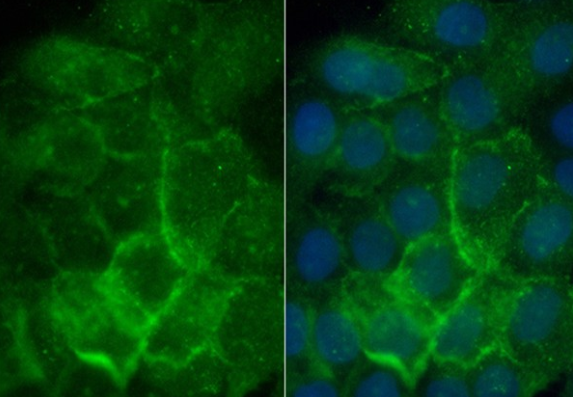 Aquaporin 3 (YD14114) Rabbit mAb
