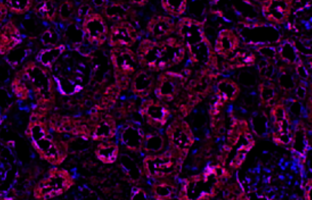 MYL9 Rabbit mAb