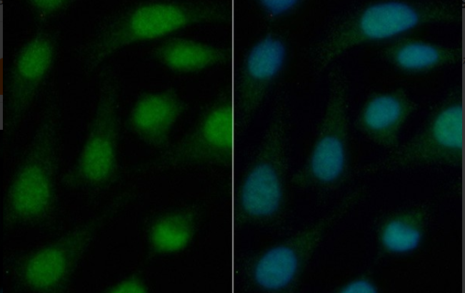 YTHDC1 (YD35320) Rabbit mAb