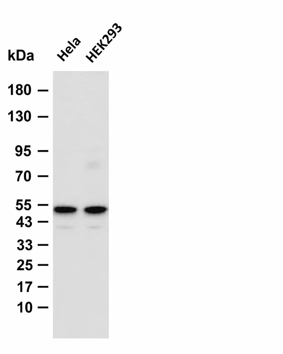 Smad3 (Phospho Ser423/Ser425)  Rabbit mAb