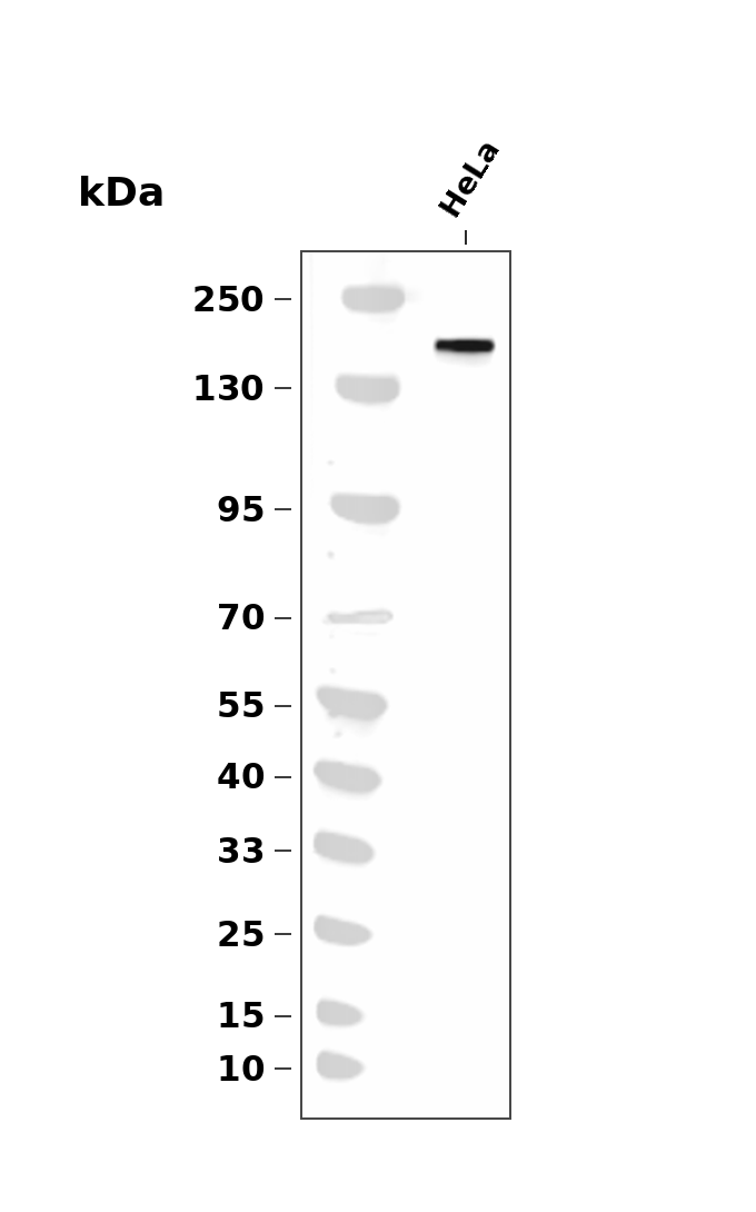 HER2 (Phospho Tyr1248) /HER4 (Phospho Tyr1284)  Rabbit mAb