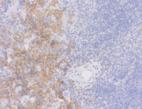EMR1 (F4/80) Rabbit mAb