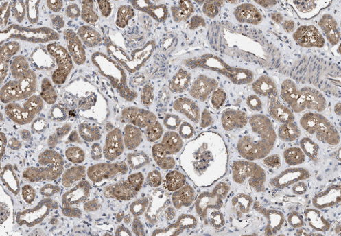 HMGCR Rabbit mAb
