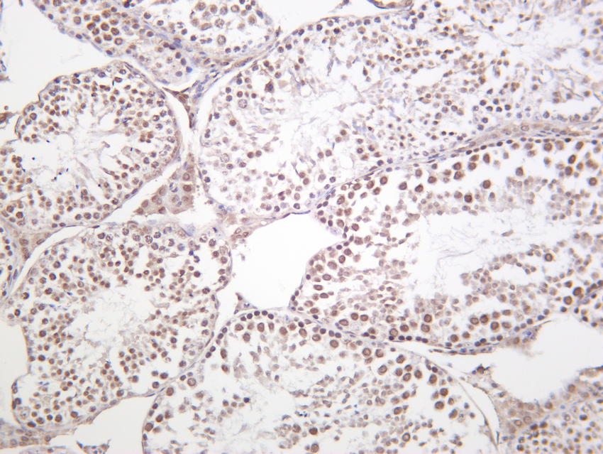 METTL3 Rabbit mAb