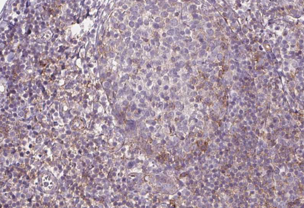 Na+/K+-ATPase &alpha;1 Mouse mAb