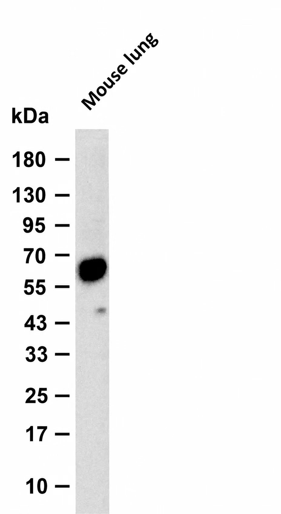 PLAUR Rabbit mAb