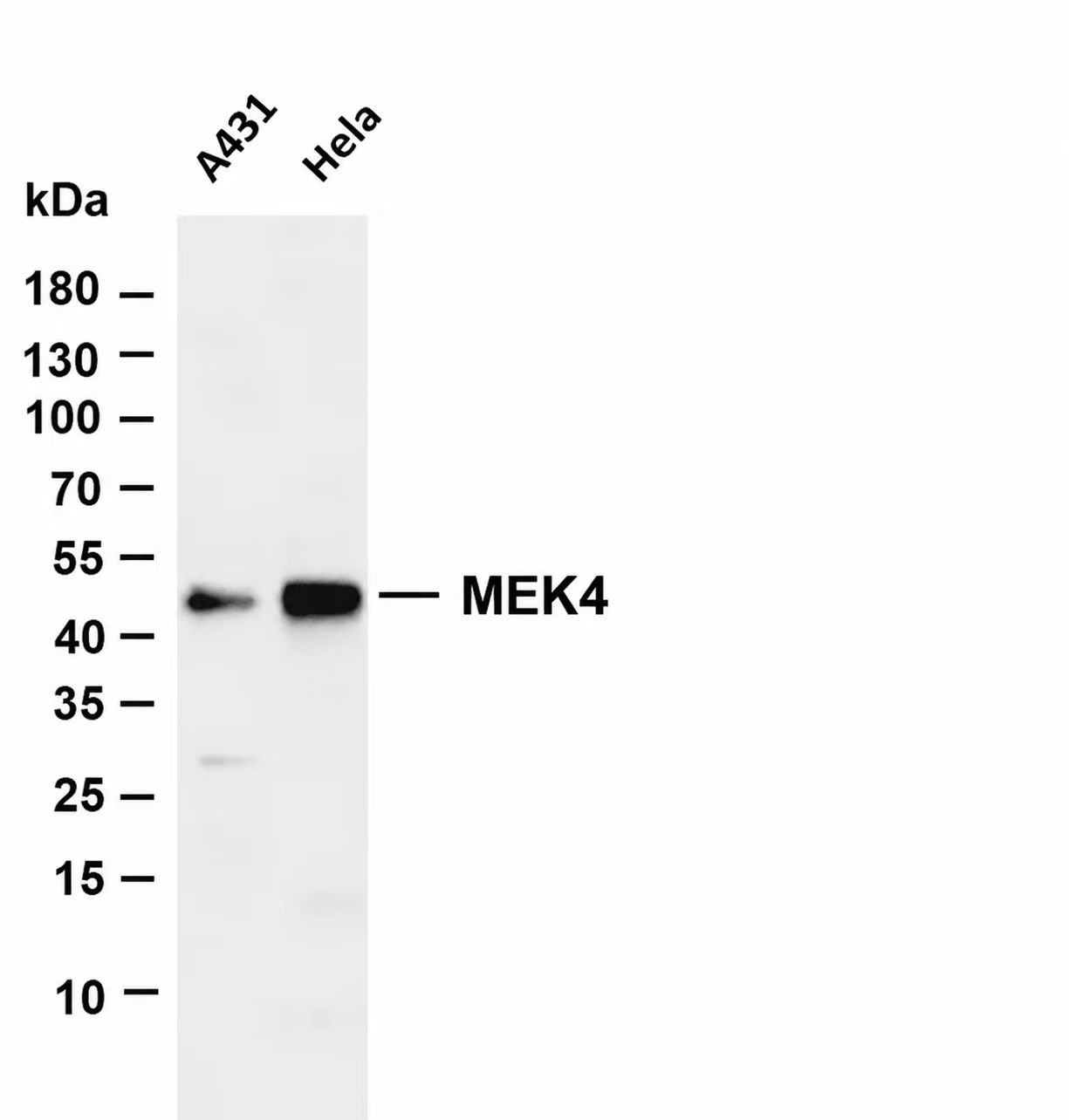MEK4 Rabbit mAb,