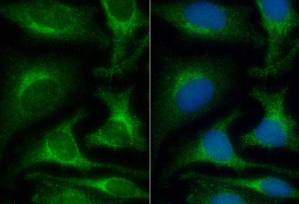 S6K1 (YD12050) Rabbit mAb