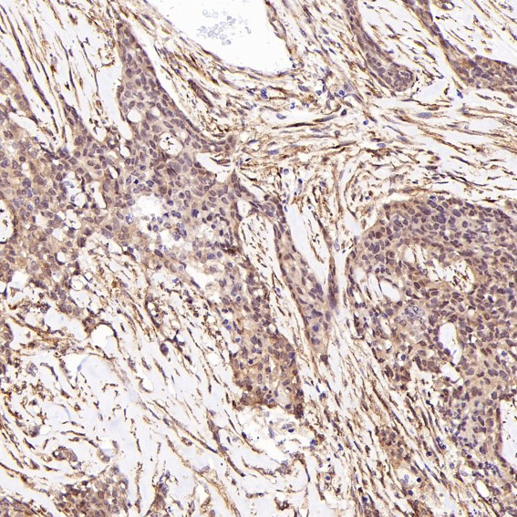 LRP1 Rabbit mAb