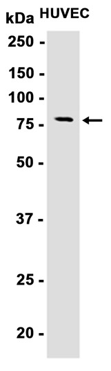 Transglutaminase 2 Rabbit mAb