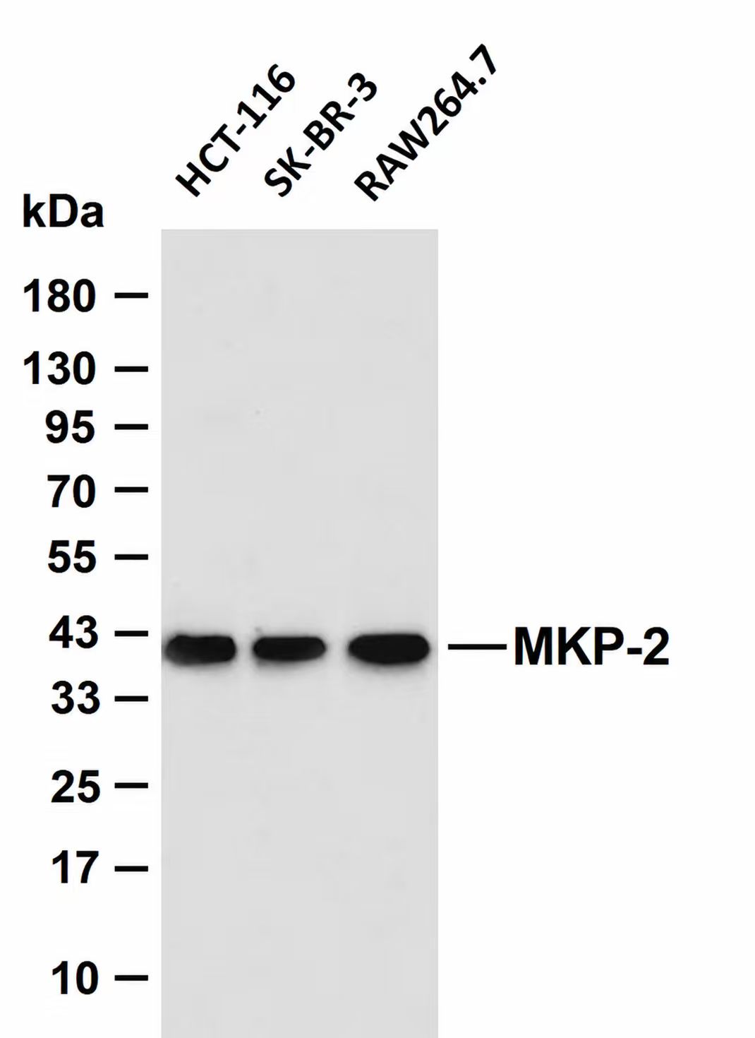 MKP-2  Rabbit mAb