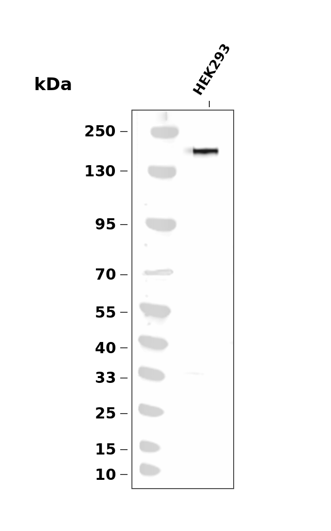 Phospho-HER2/ErbB2 (Tyr1248) pAb