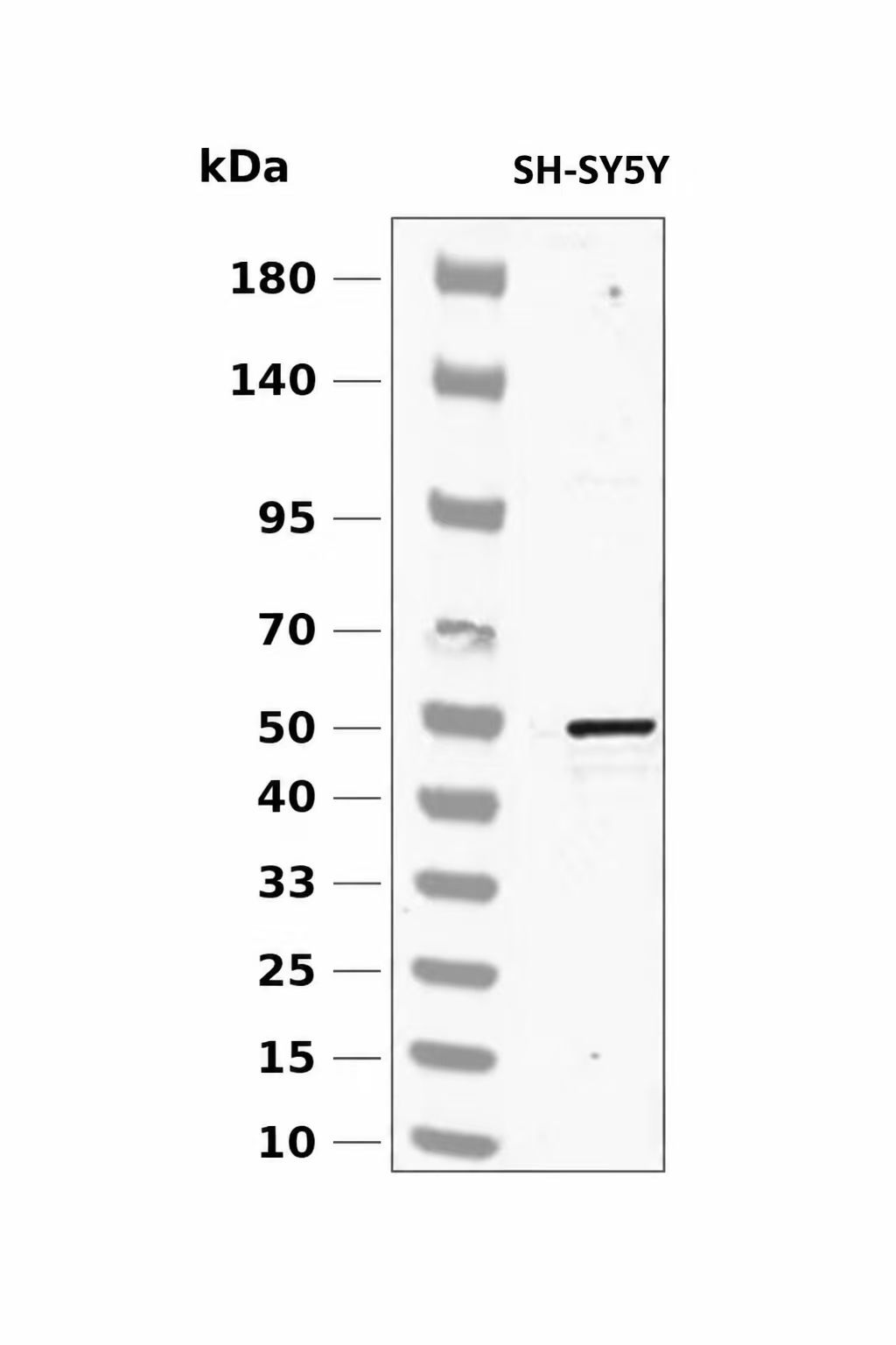 Tryptophan Hydroxylase (YD14751) Rabbit mAb
