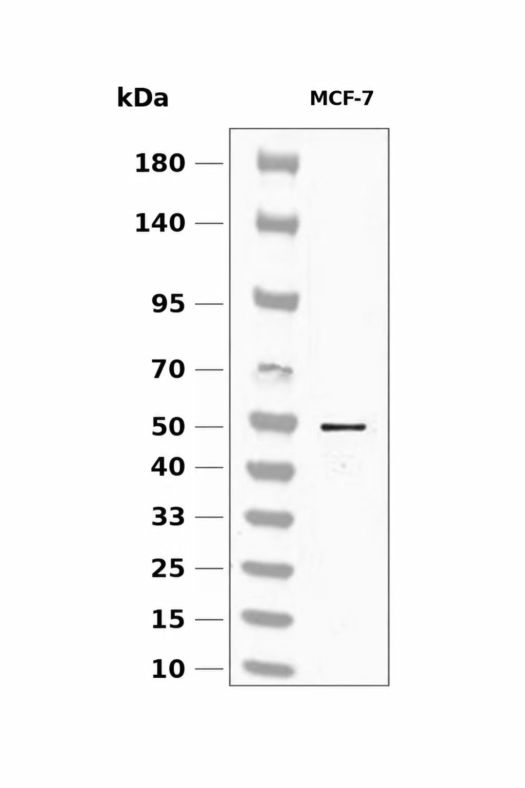 Tryptophan Hydroxylase (Phospho-Ser58) Antibody